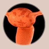 Аватарка канала Эндометриоз/Аденомиоз/Эндометриоидные кисты dr.shefova